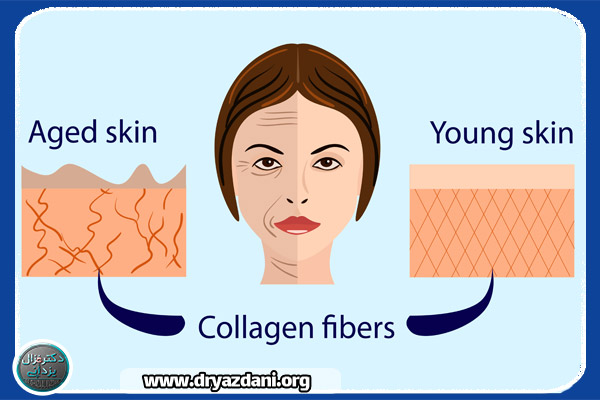 کلاژن چیست ؟ | معرفی انواع روش ها - دکتر غزال یزدانی